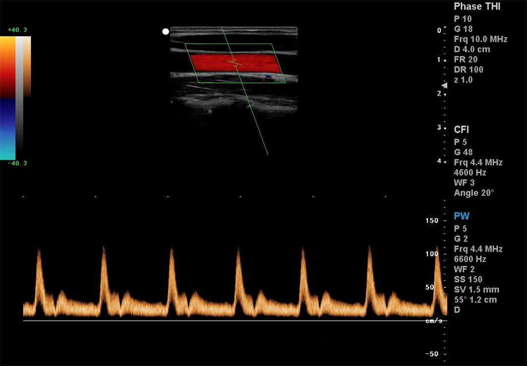 Color Doppler imaging (6)