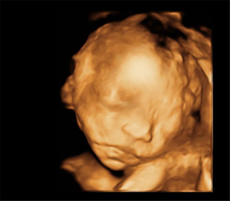 What Are The Advantages Of 4D B Ultrasound Machine